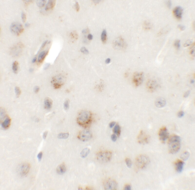AP3B2 Antibody - BSA Free