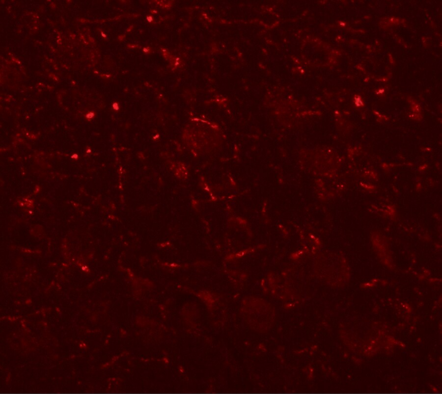 AP3B2 Antibody - BSA Free