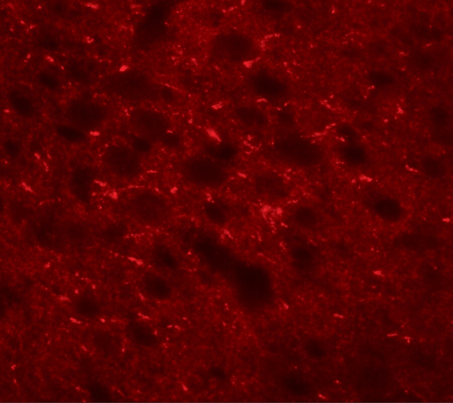 TMEM88 Antibody - BSA Free