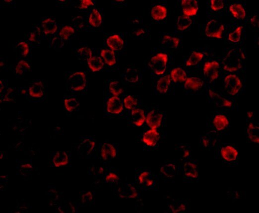 TAB1 Antibody - BSA Free