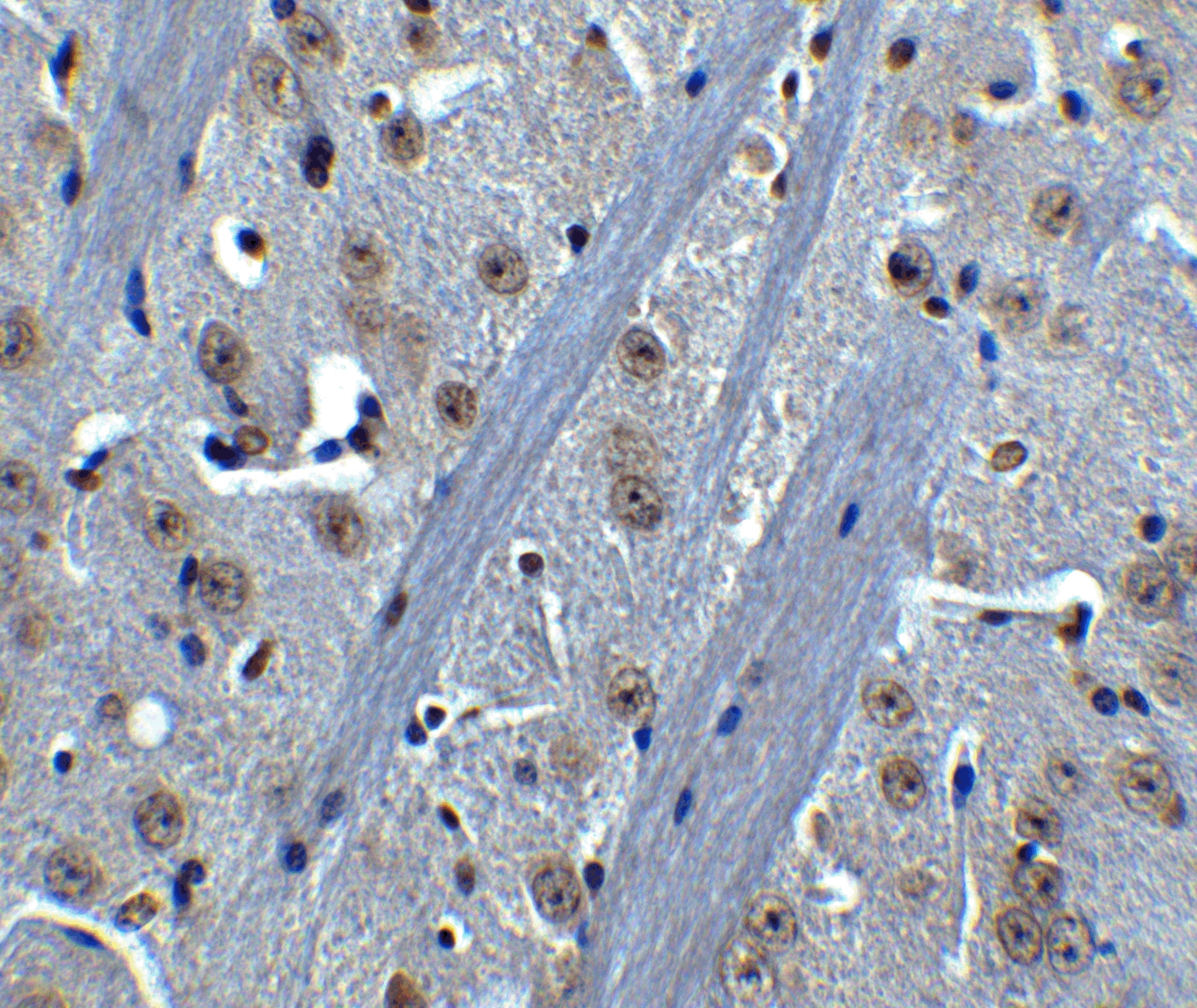 BTK Antibody - BSA Free