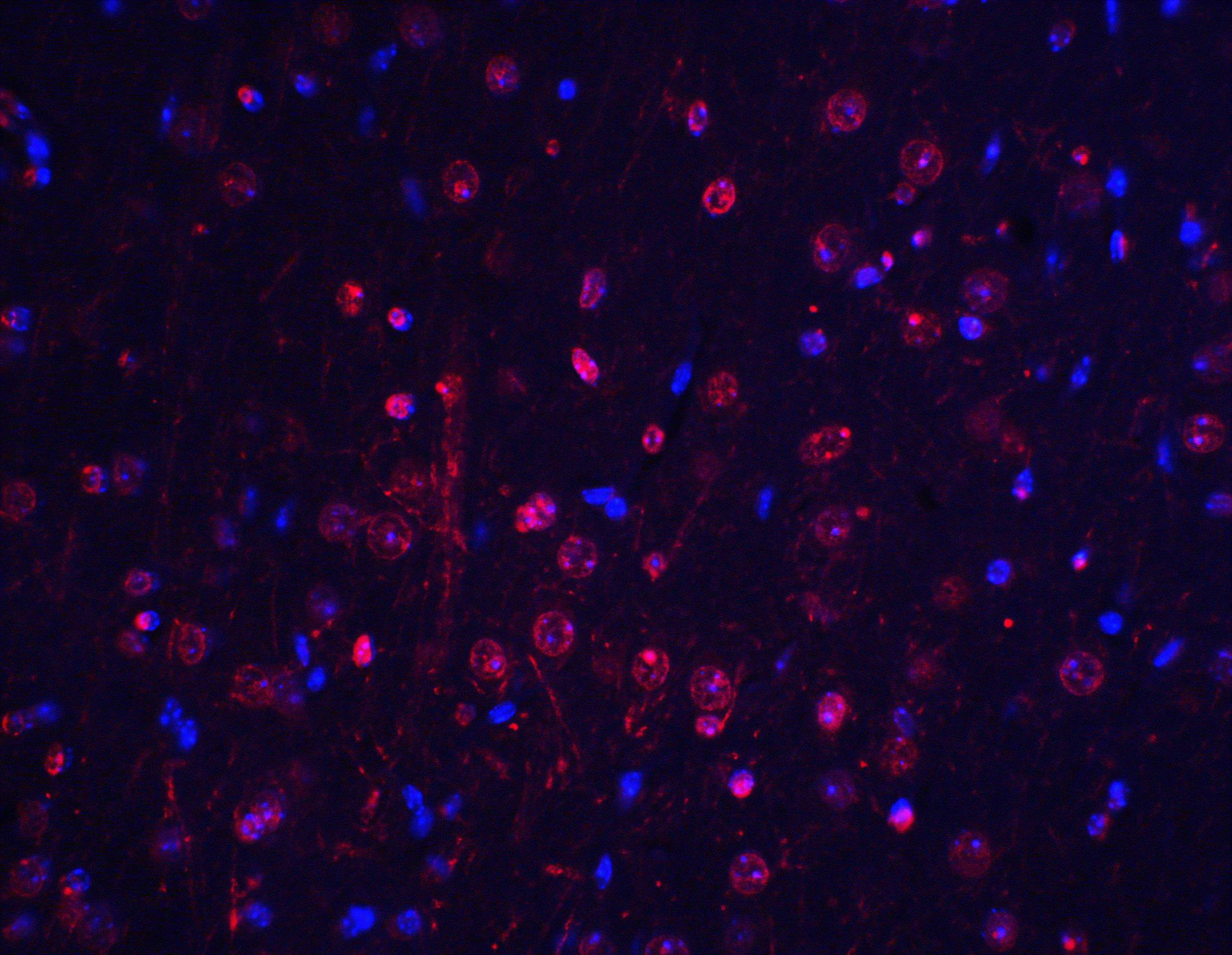 BTK Antibody - BSA Free