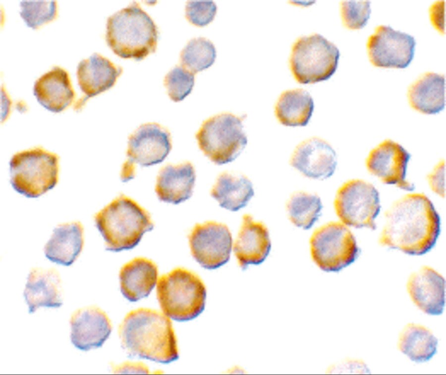 SIGIRR Antibody - BSA Free