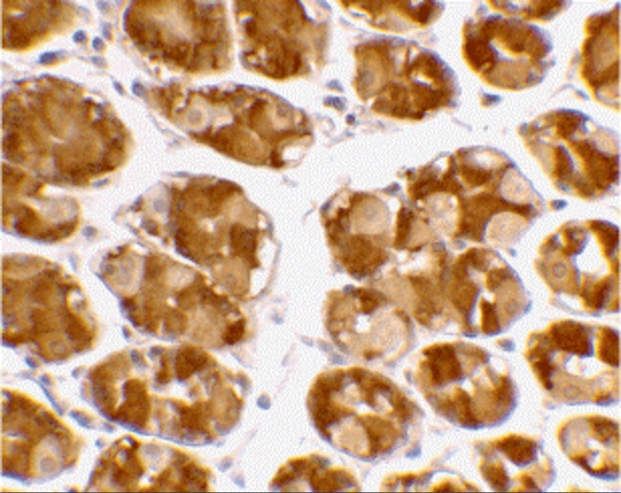 TRIM5 alpha Antibody - BSA Free