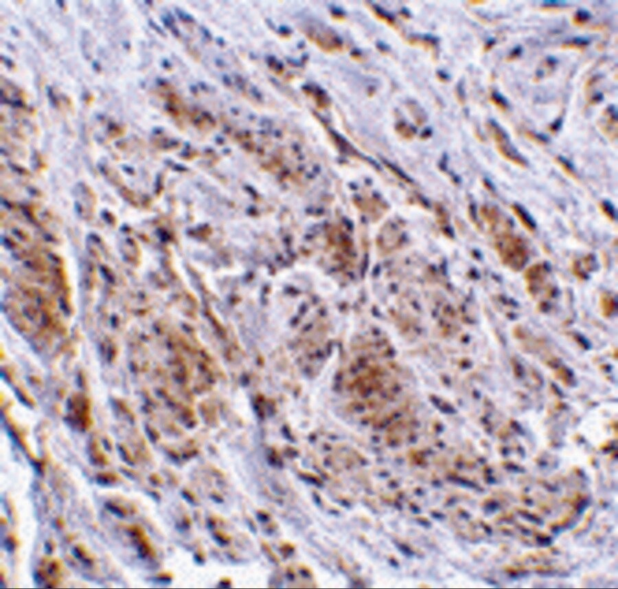 TRIM5 gamma Antibody - BSA Free