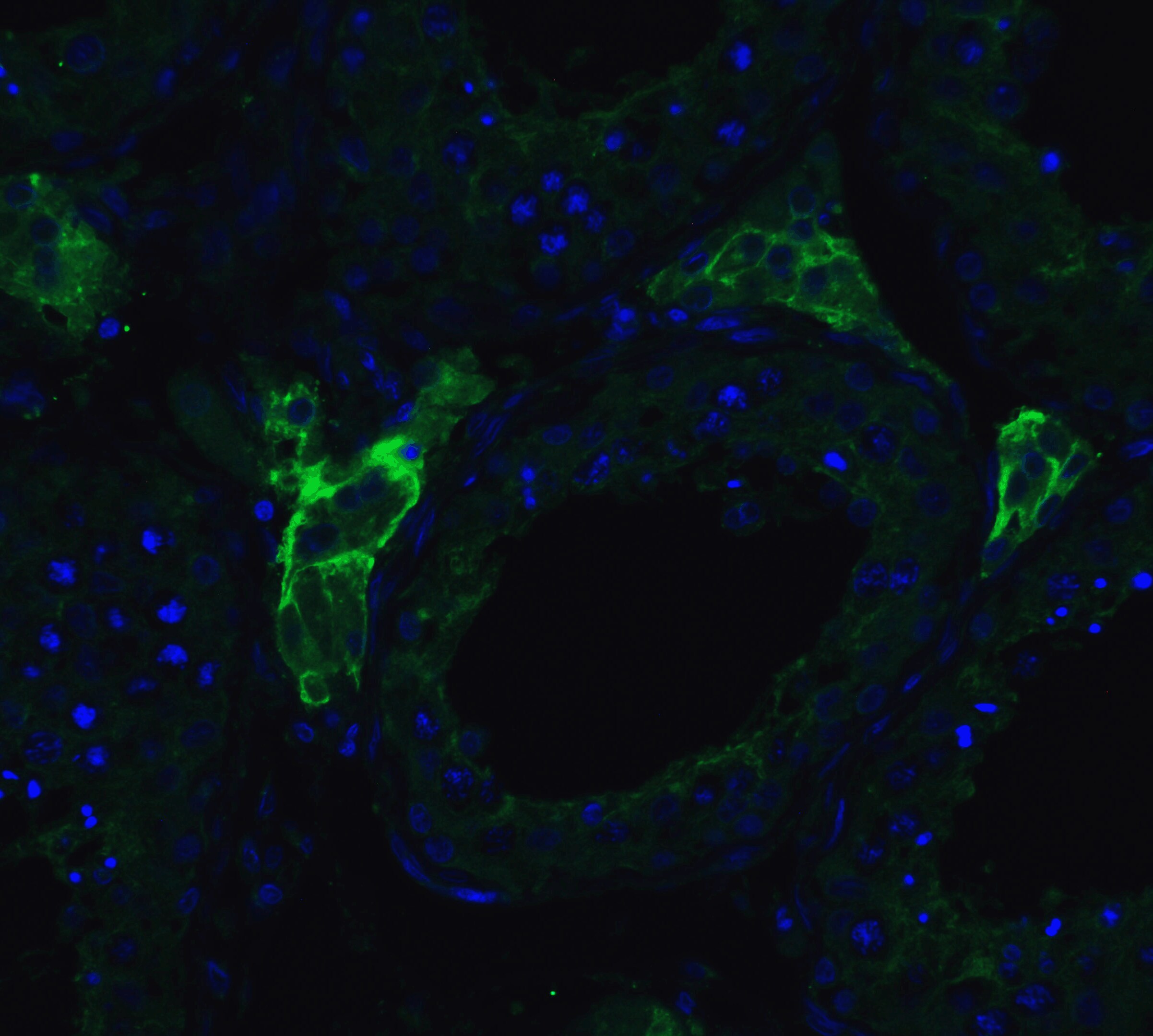 ACE-2 Antibody - BSA Free