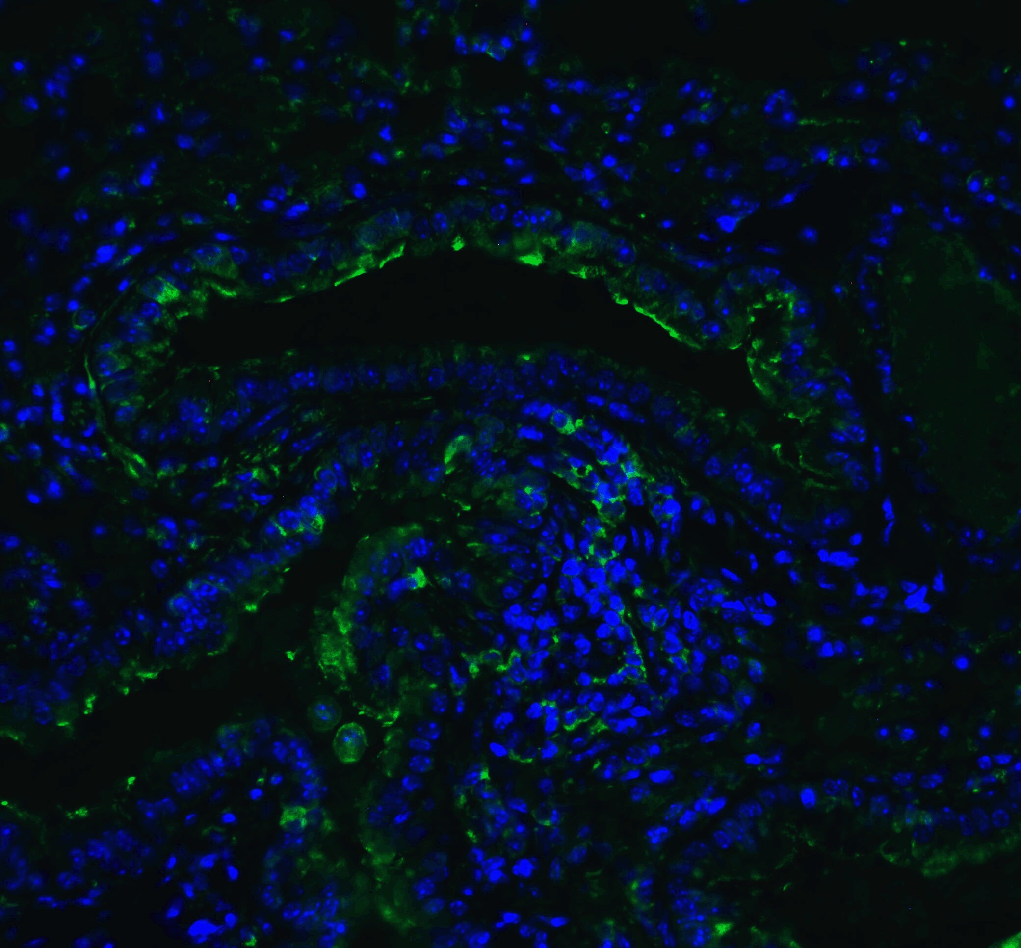 ACE-2 Antibody - BSA Free