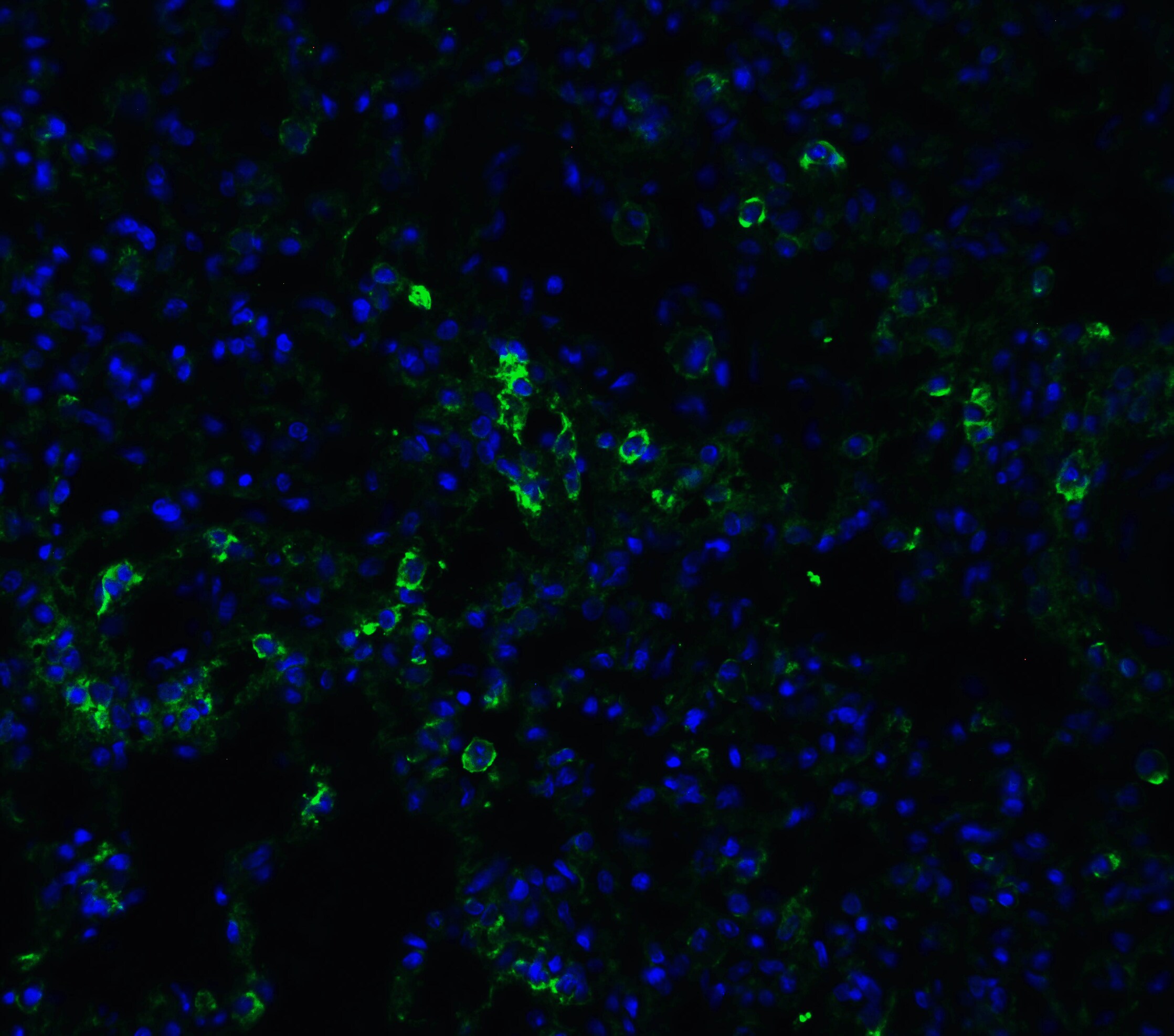 ACE-2 Antibody - BSA Free