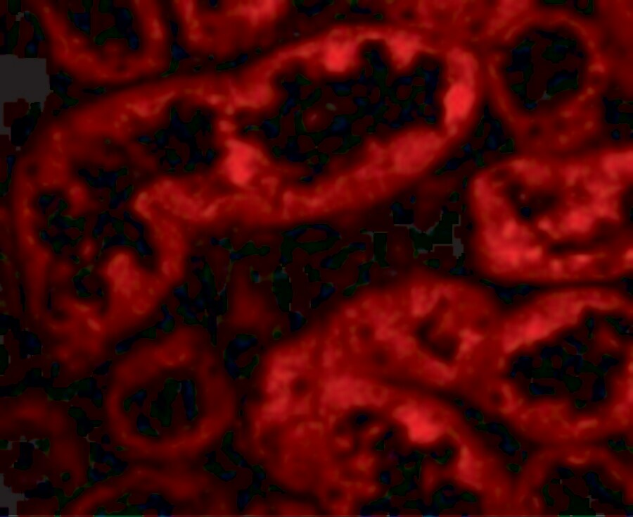 ACE-2 Antibody - BSA Free