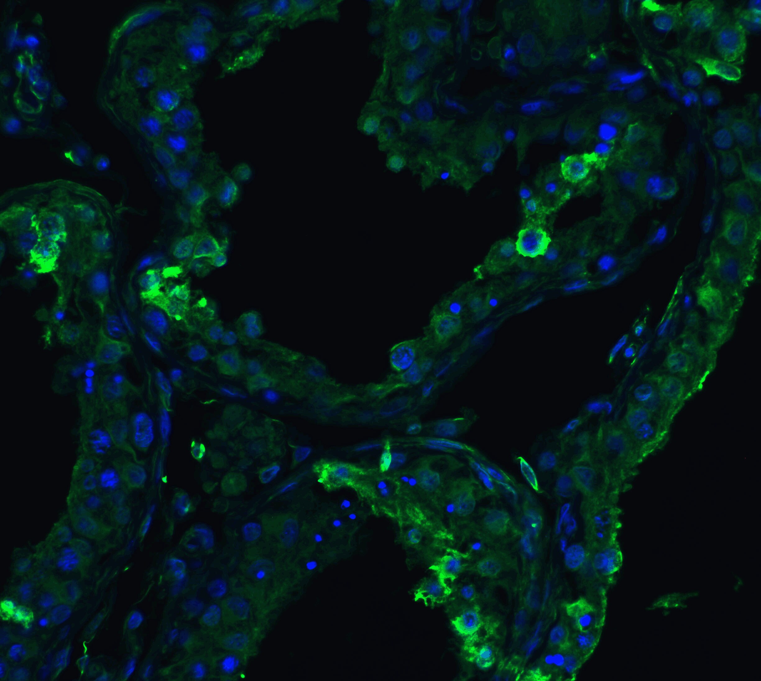 ACE-2 Antibody - BSA Free