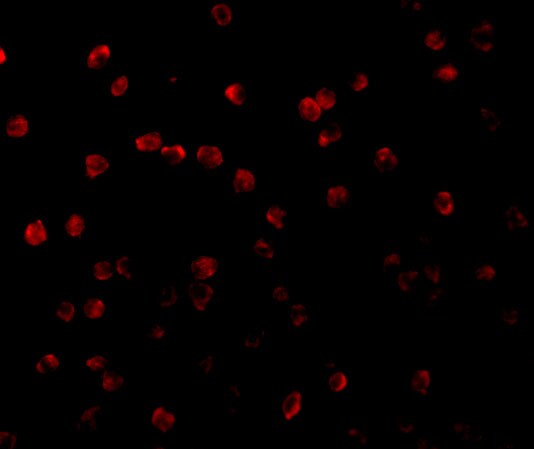 RSK1 Antibody - BSA Free