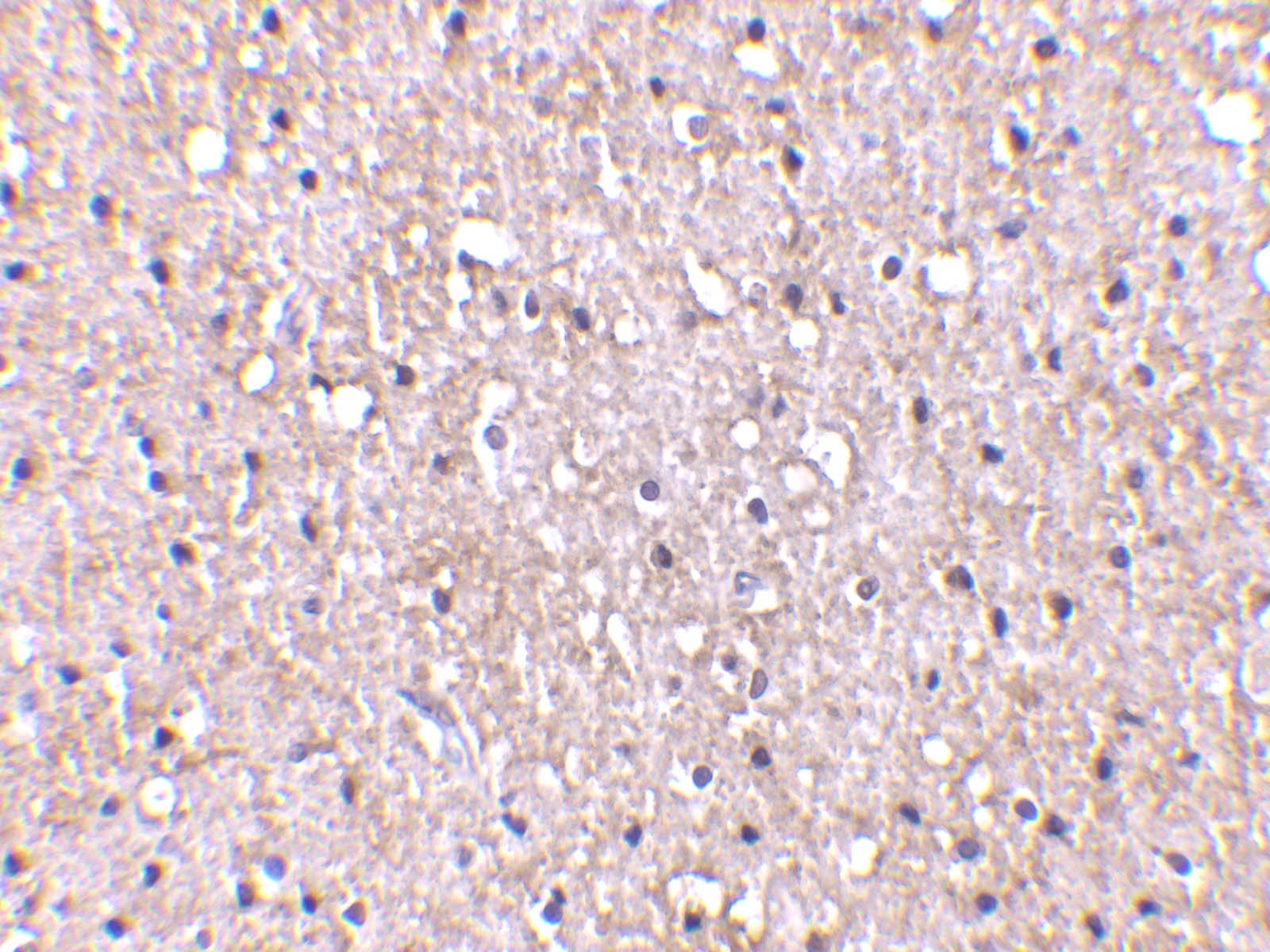 C1qTNF5/CTRP5 Antibody - BSA Free