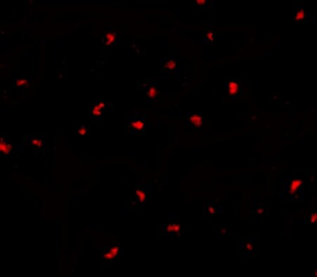 PAK6 Antibody - BSA Free