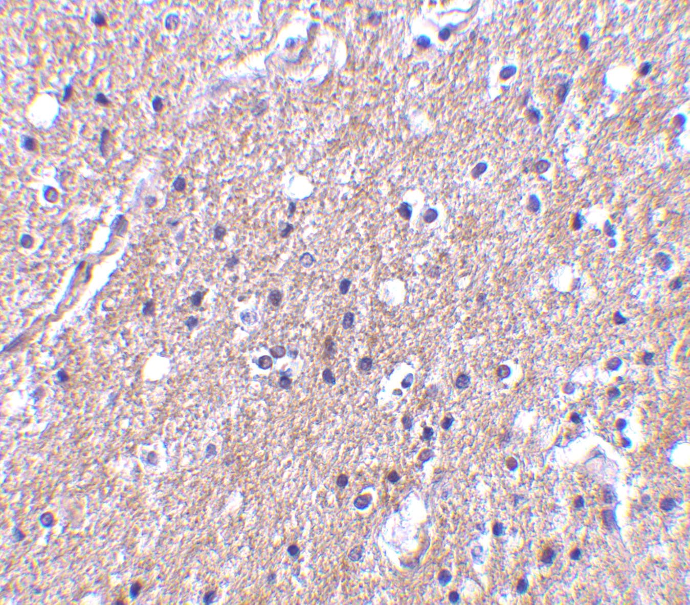 CTRP6 Antibody - BSA Free