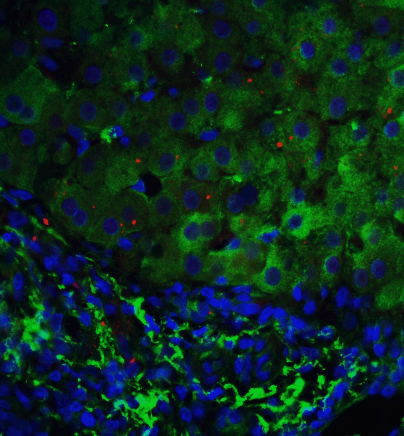 p53 DINP1 Antibody - BSA Free
