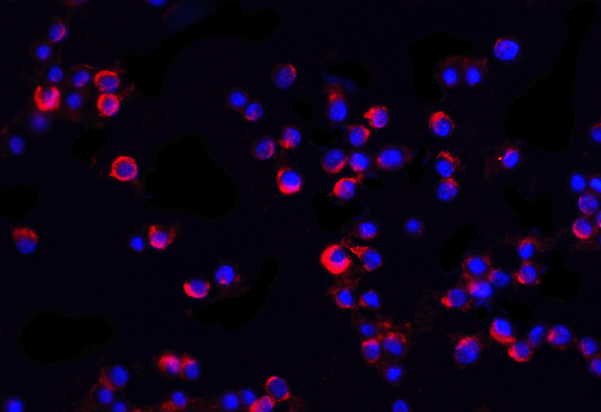 IRAK2 Antibody - BSA Free