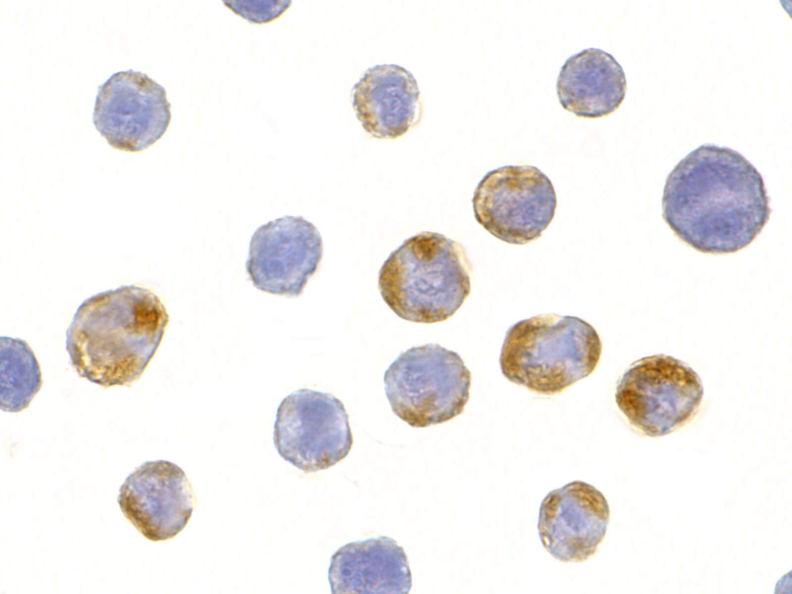 GRG (Groucho homolog) Antibody - BSA Free