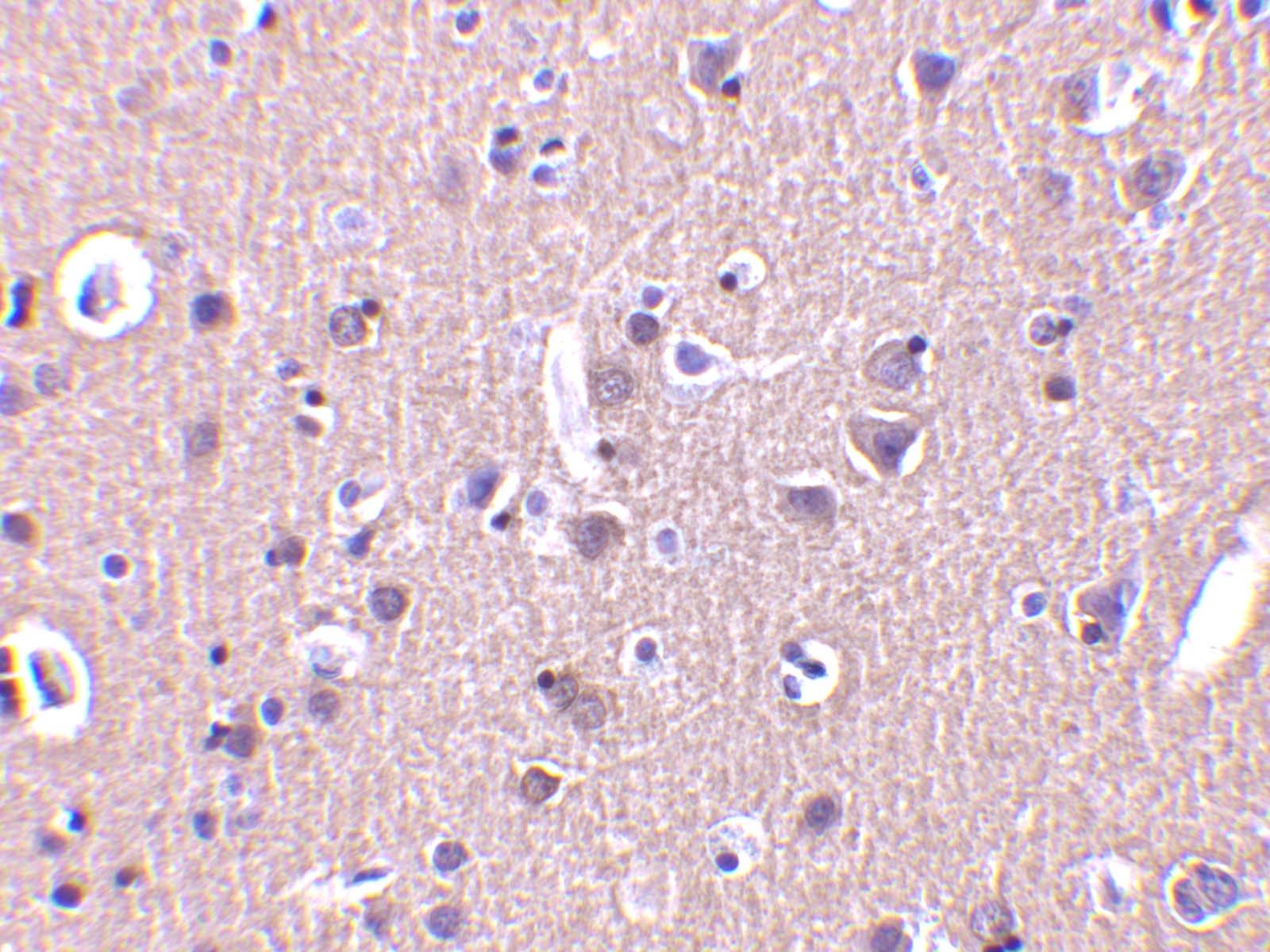 CRMP1 Antibody - BSA Free