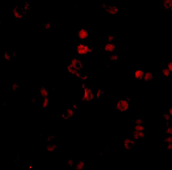 AATF Antibody - BSA Free