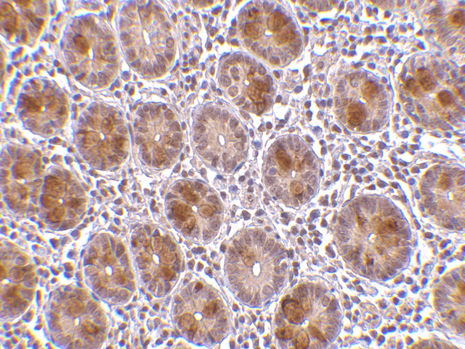 AATF Antibody - BSA Free