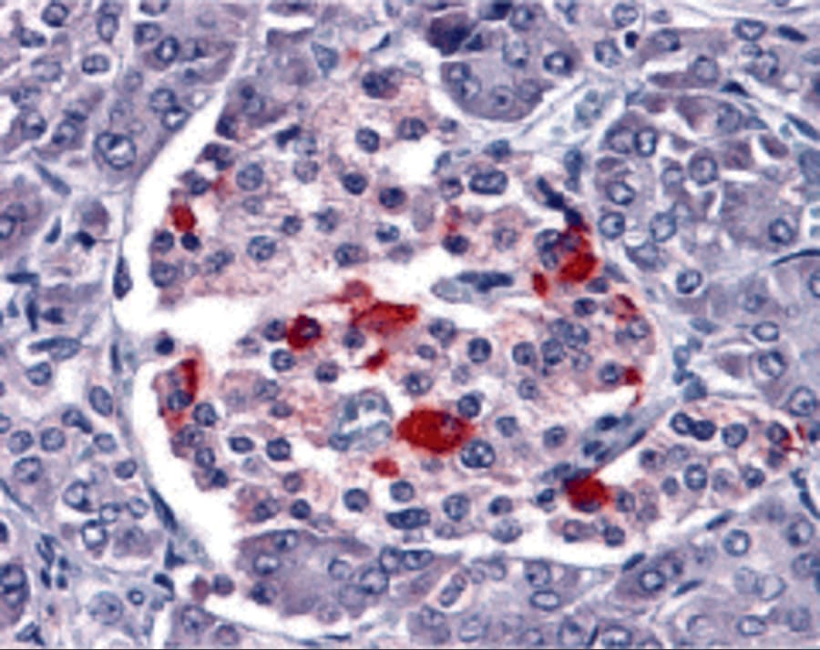 Endo G Antibody - BSA Free