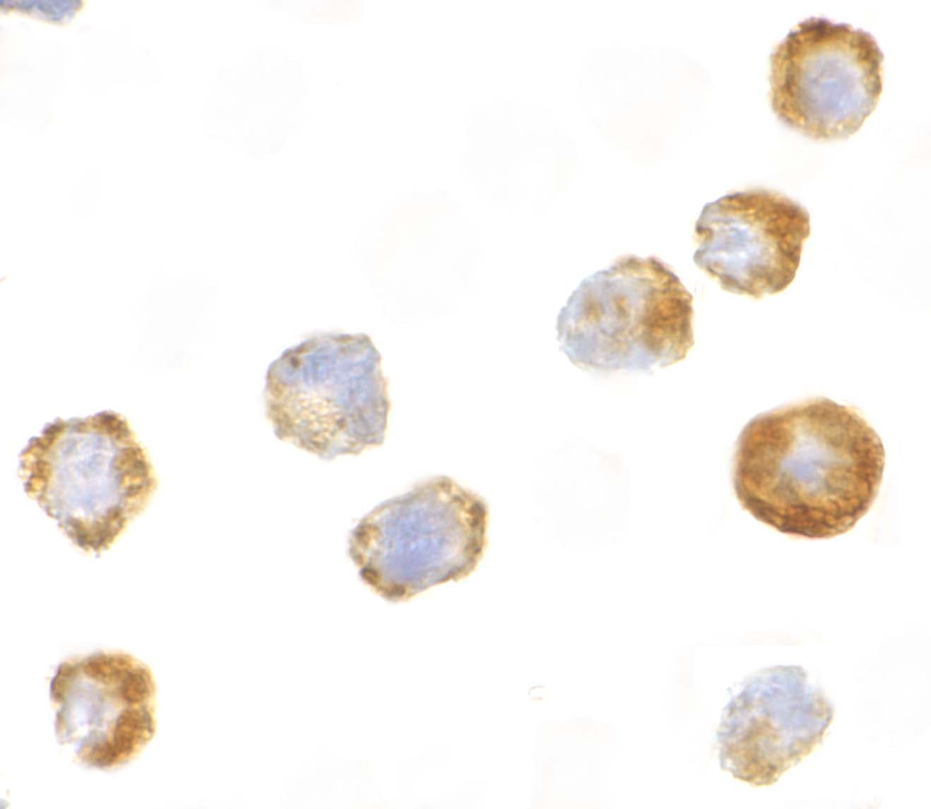 ASK1 Antibody - BSA Free