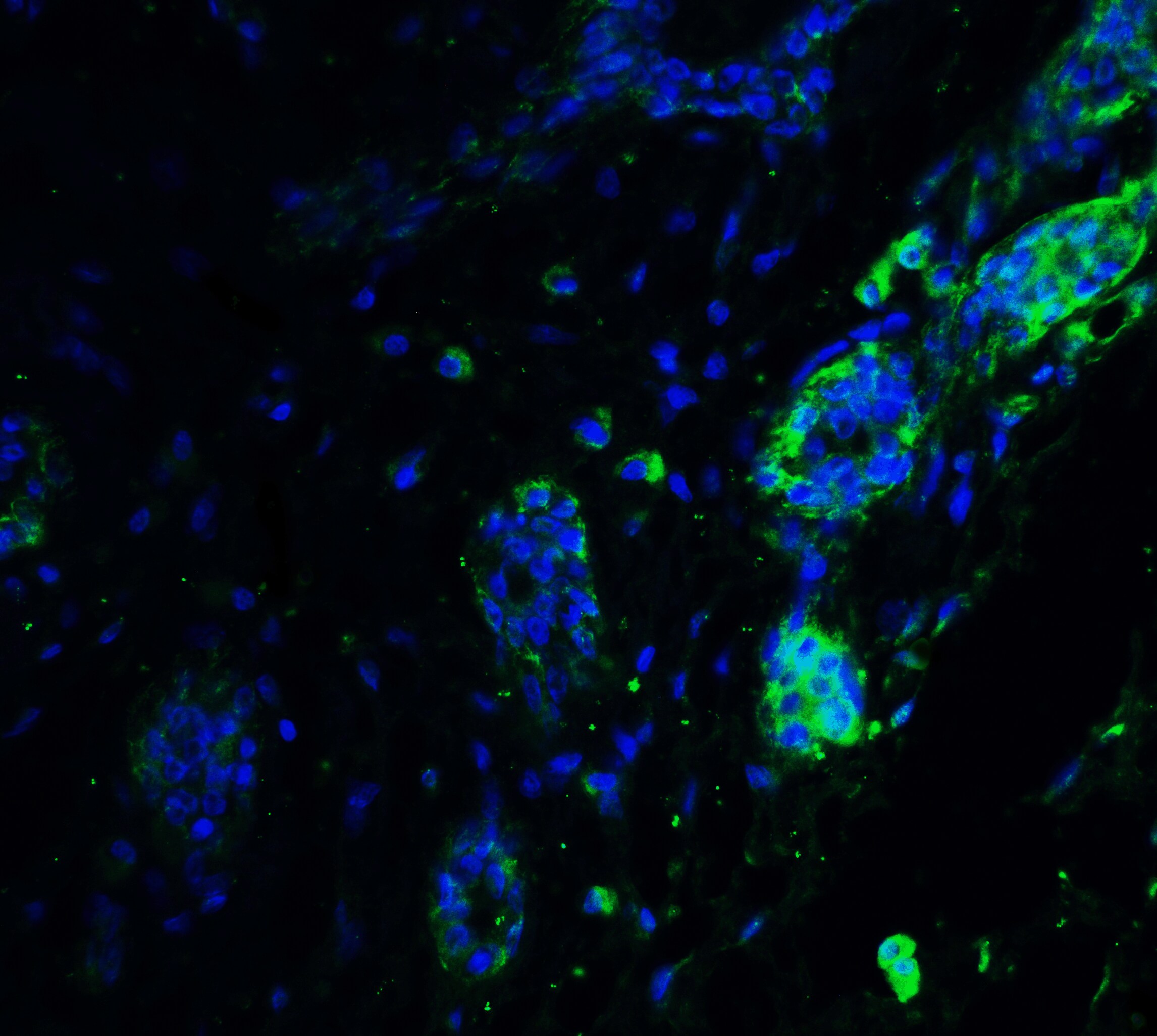 ATF6 Antibody - BSA Free