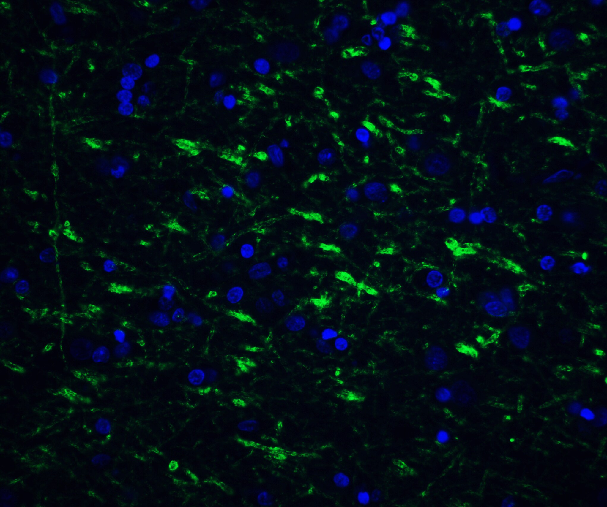 Tollip Antibody - BSA Free