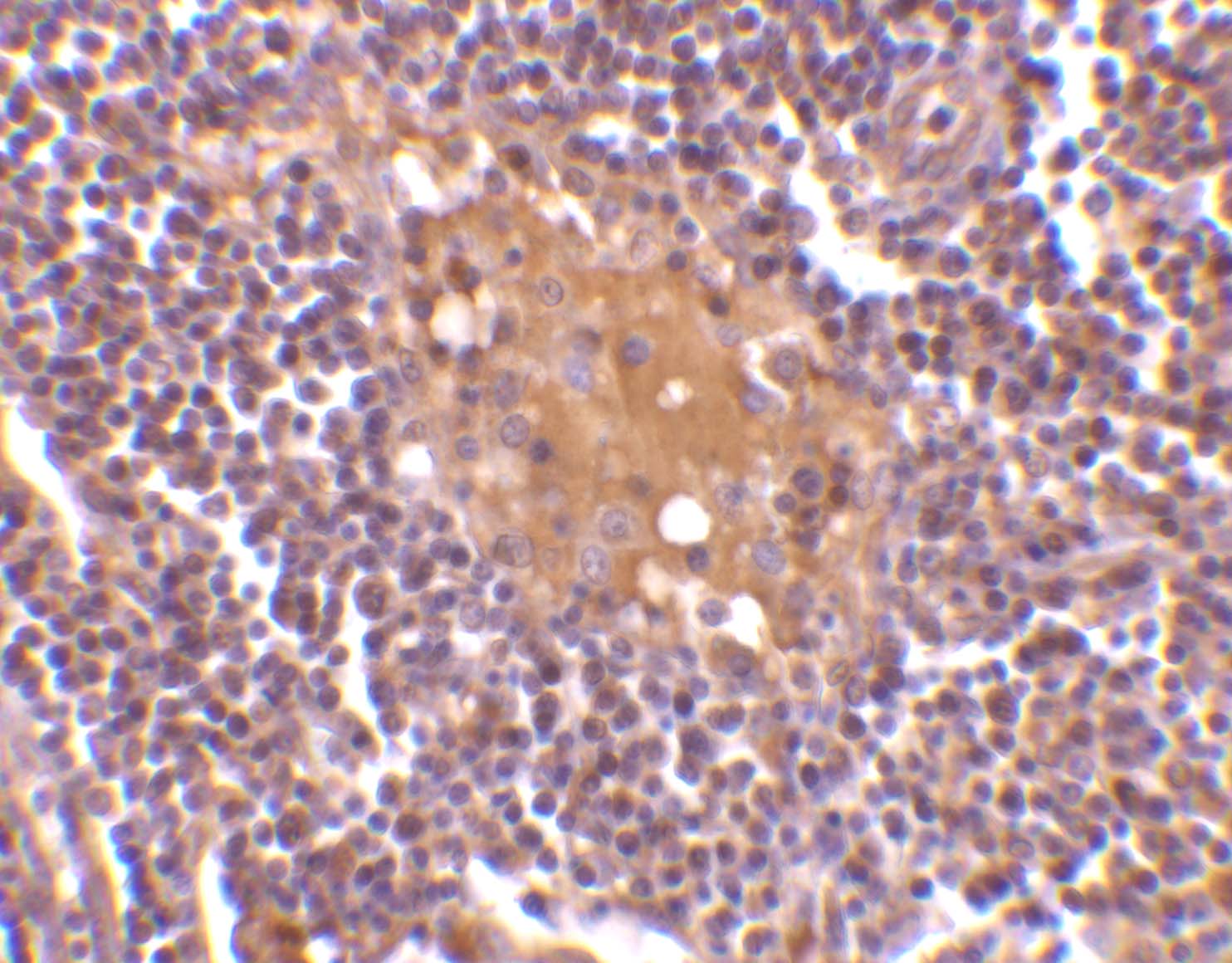 CD5L Antibody - BSA Free