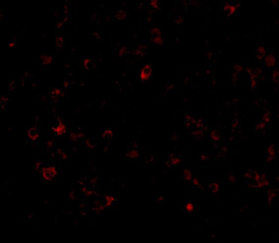 CD5L Antibody - BSA Free