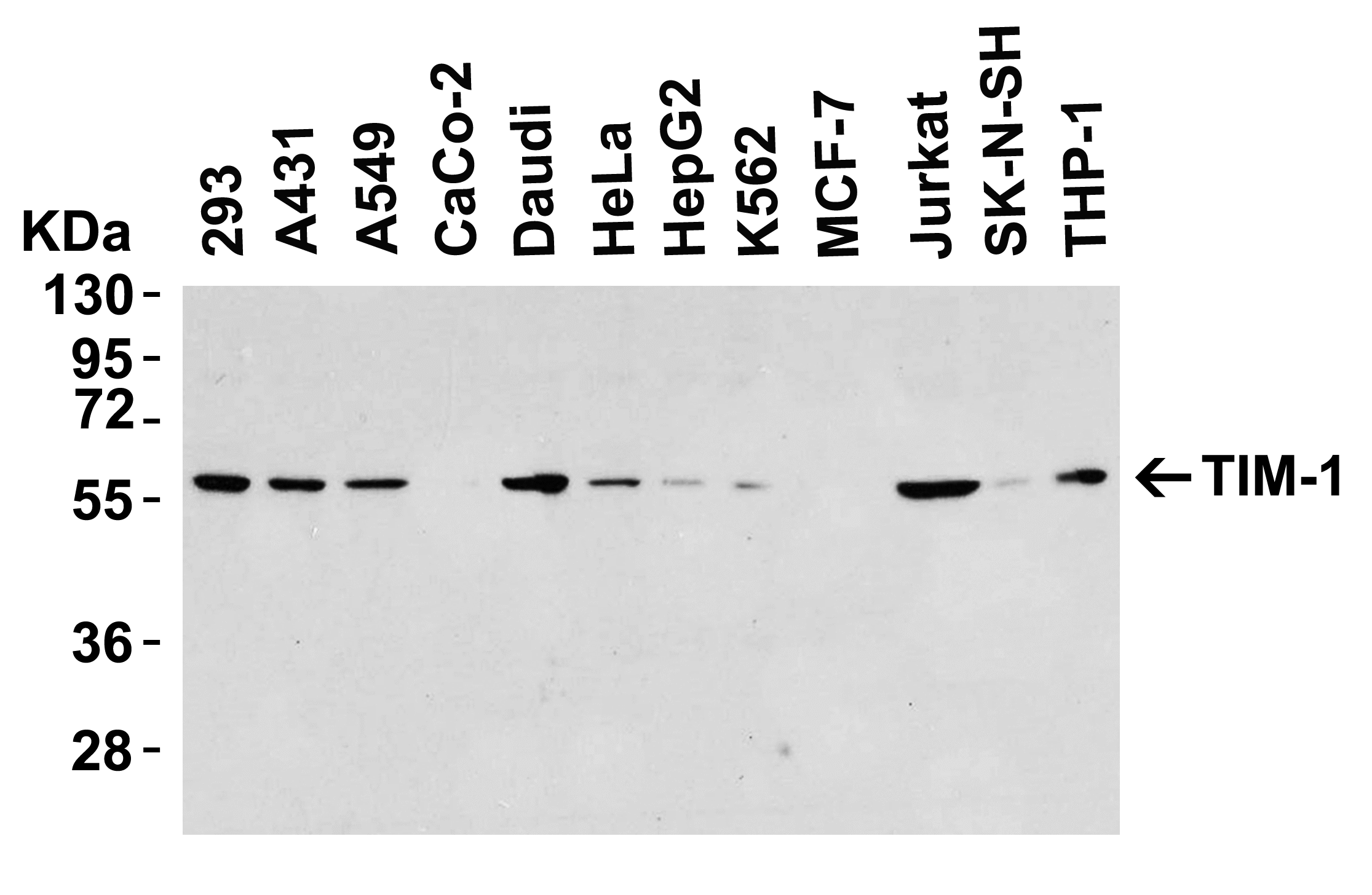 TIM-1/KIM-1/HAVCR Antibody - BSA Free
