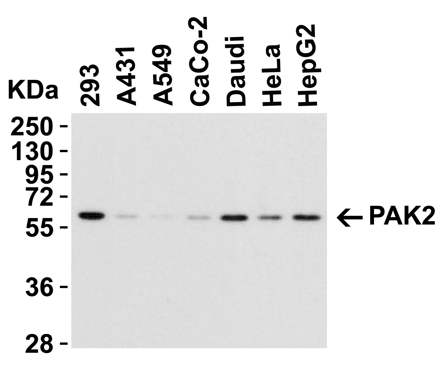 PAK2 Antibody - BSA Free