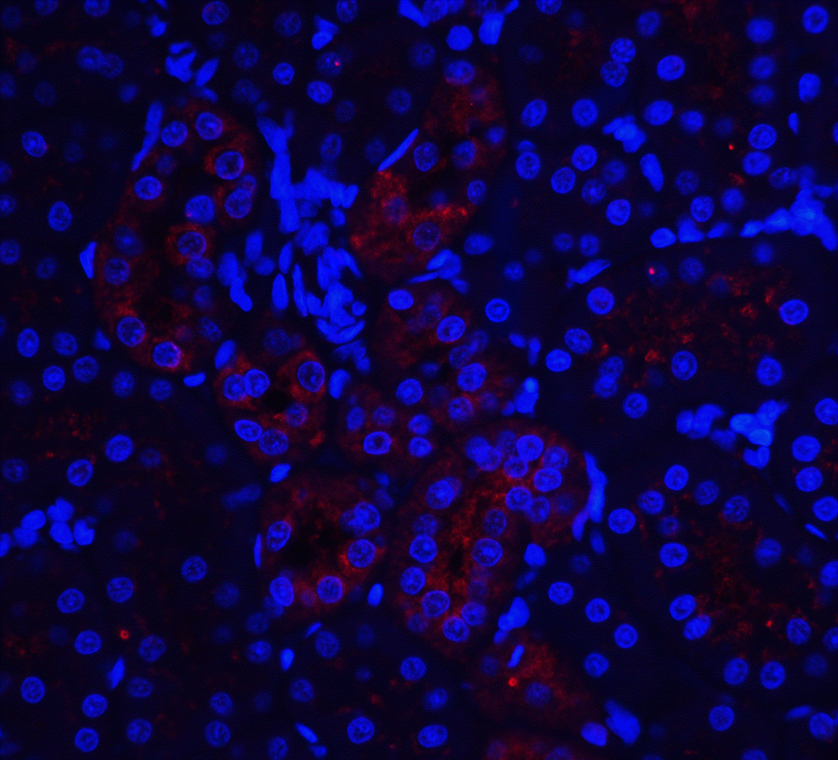 IL-22R alpha 1 Antibody - BSA Free