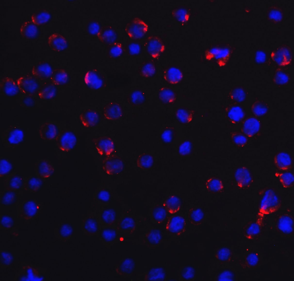RIG-I Antibody - BSA Free