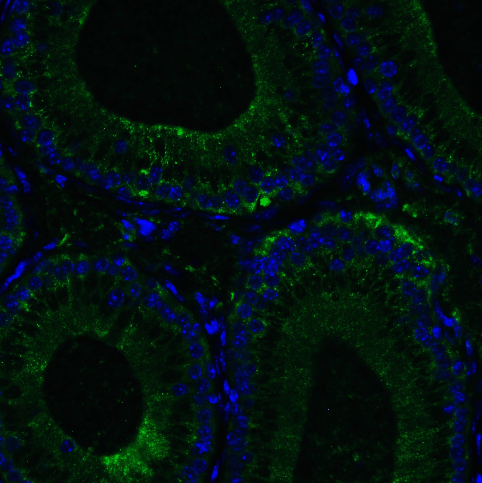 RIG-I Antibody - BSA Free