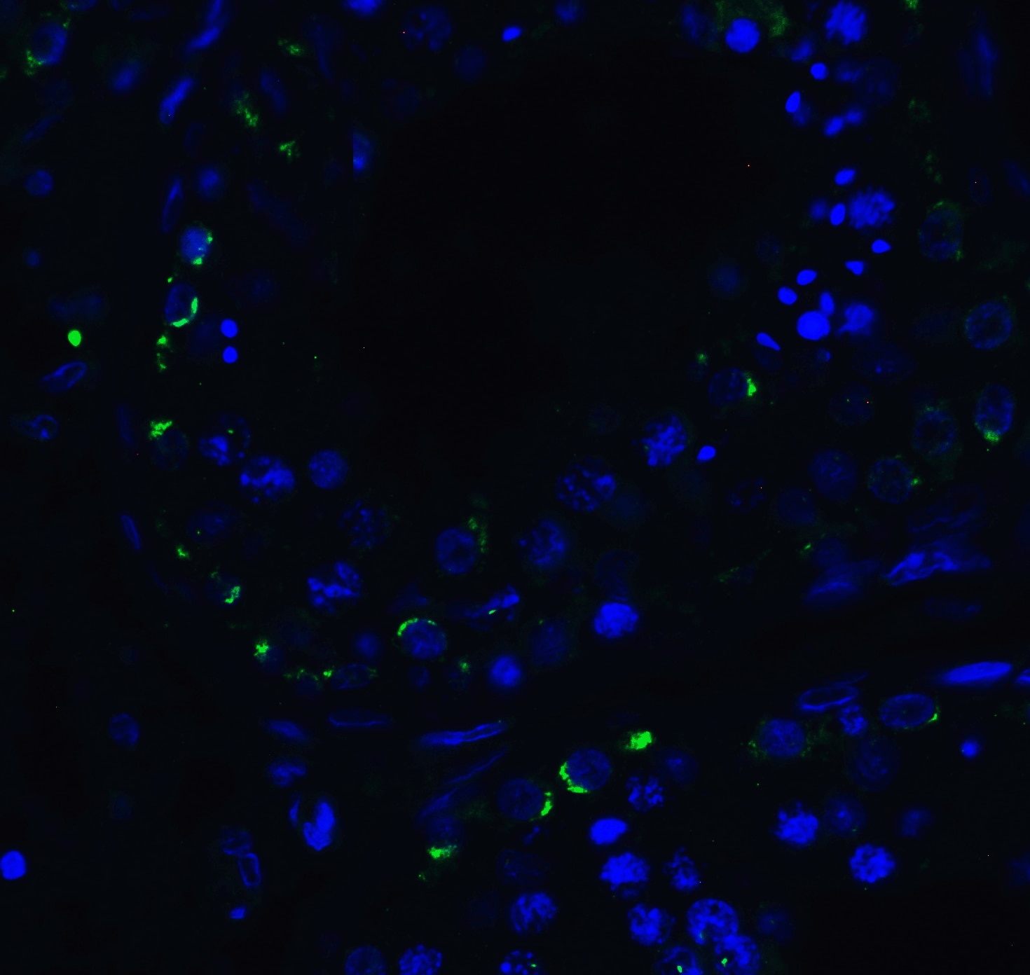 RIG-I Antibody - BSA Free