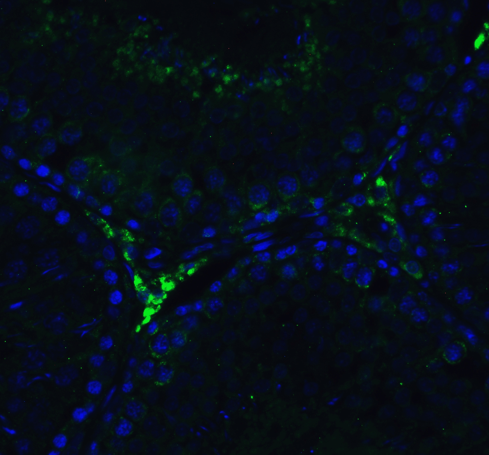 RIG-I Antibody - BSA Free