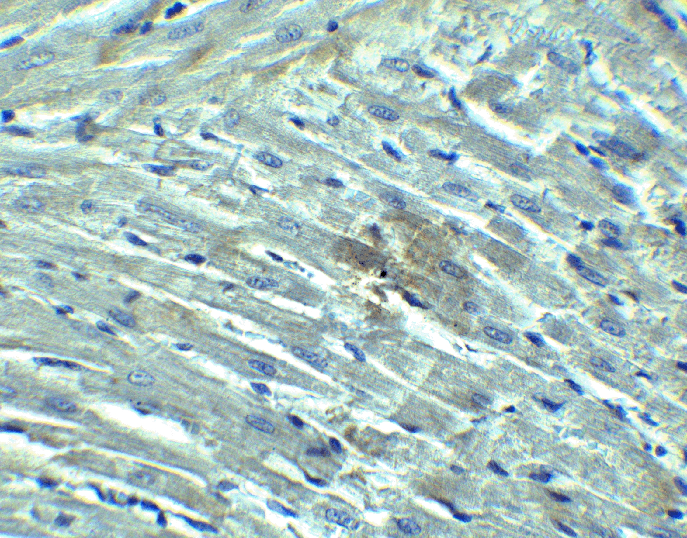 RIG-I Antibody - BSA Free