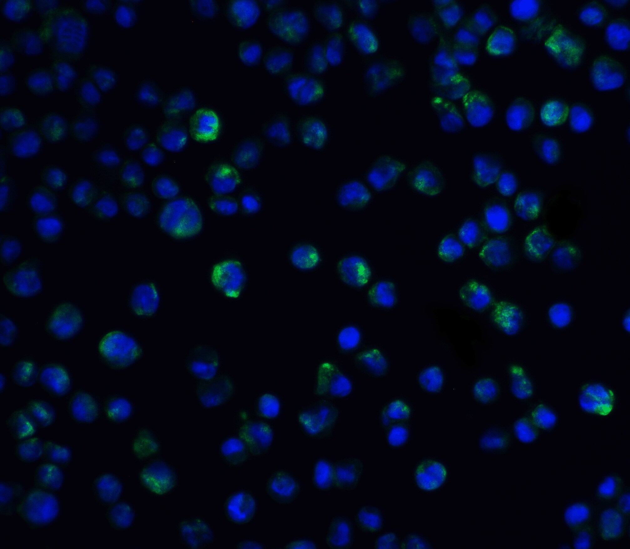 IL-21R Antibody - BSA Free
