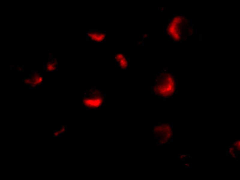 MTA2 Antibody - BSA Free