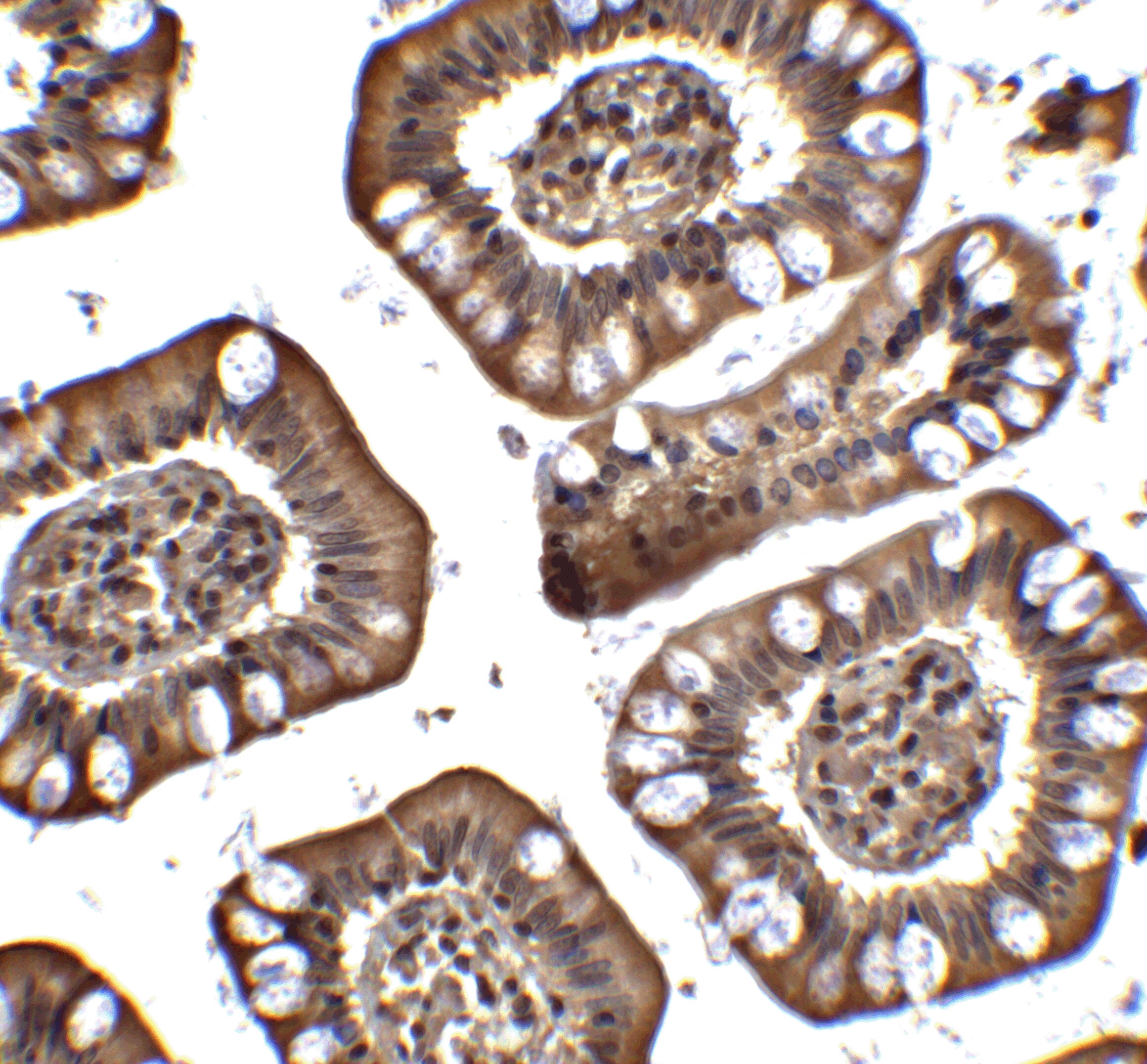 MTA2 Antibody - BSA Free