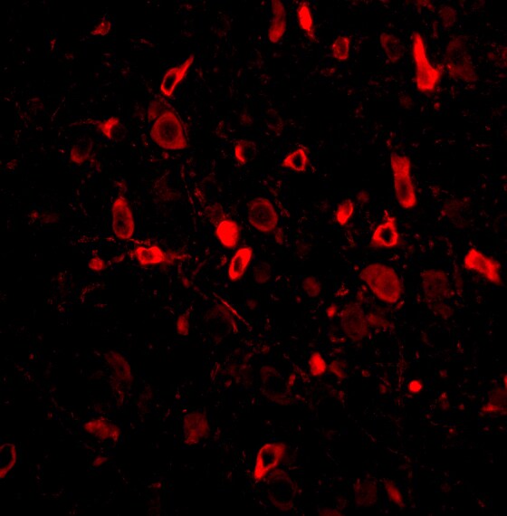 TSLP Antibody - BSA Free