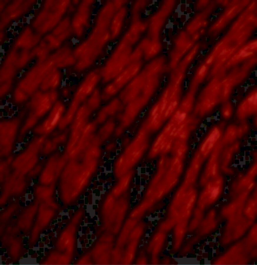 CRTH-2/GPR44 Antibody - BSA Free