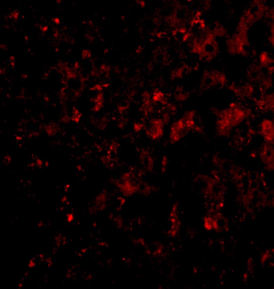 DRAM Antibody - BSA Free