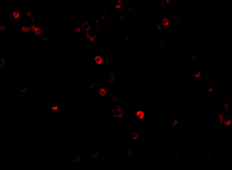 MDA5 Antibody - BSA Free
