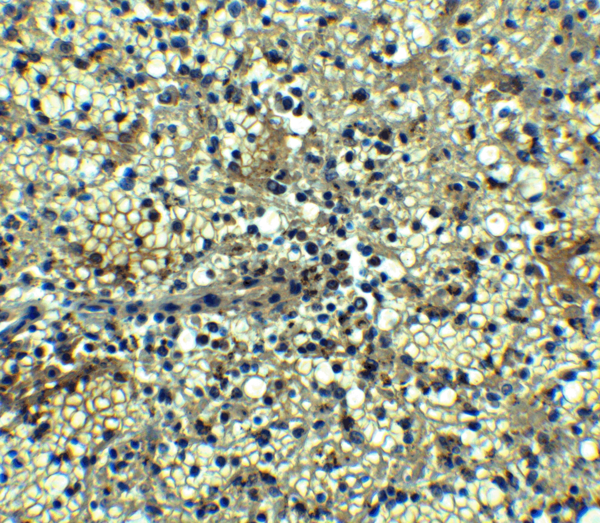 BCMA/TNFRSF17 Antibody - BSA Free