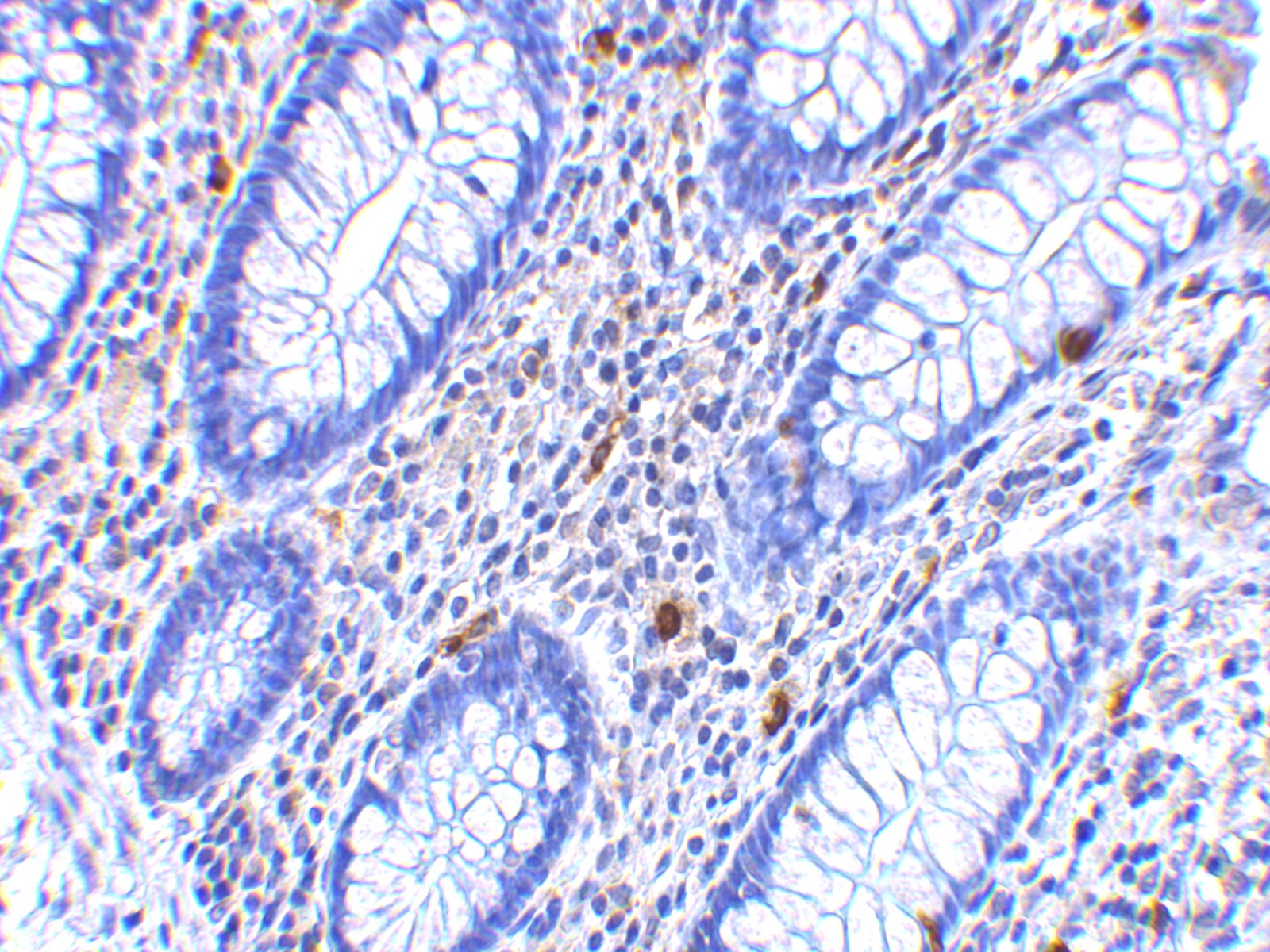 CD82/Kai-1 Antibody - BSA Free