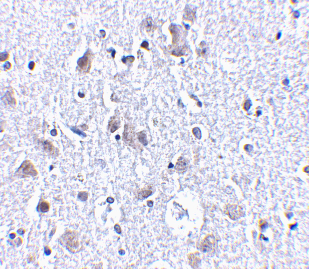 BRSK1 Antibody - BSA Free