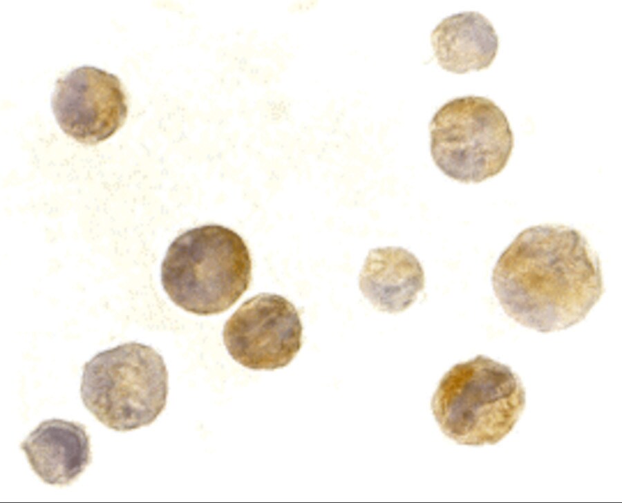 TACI/TNFRSF13B/CVID Antibody - BSA Free