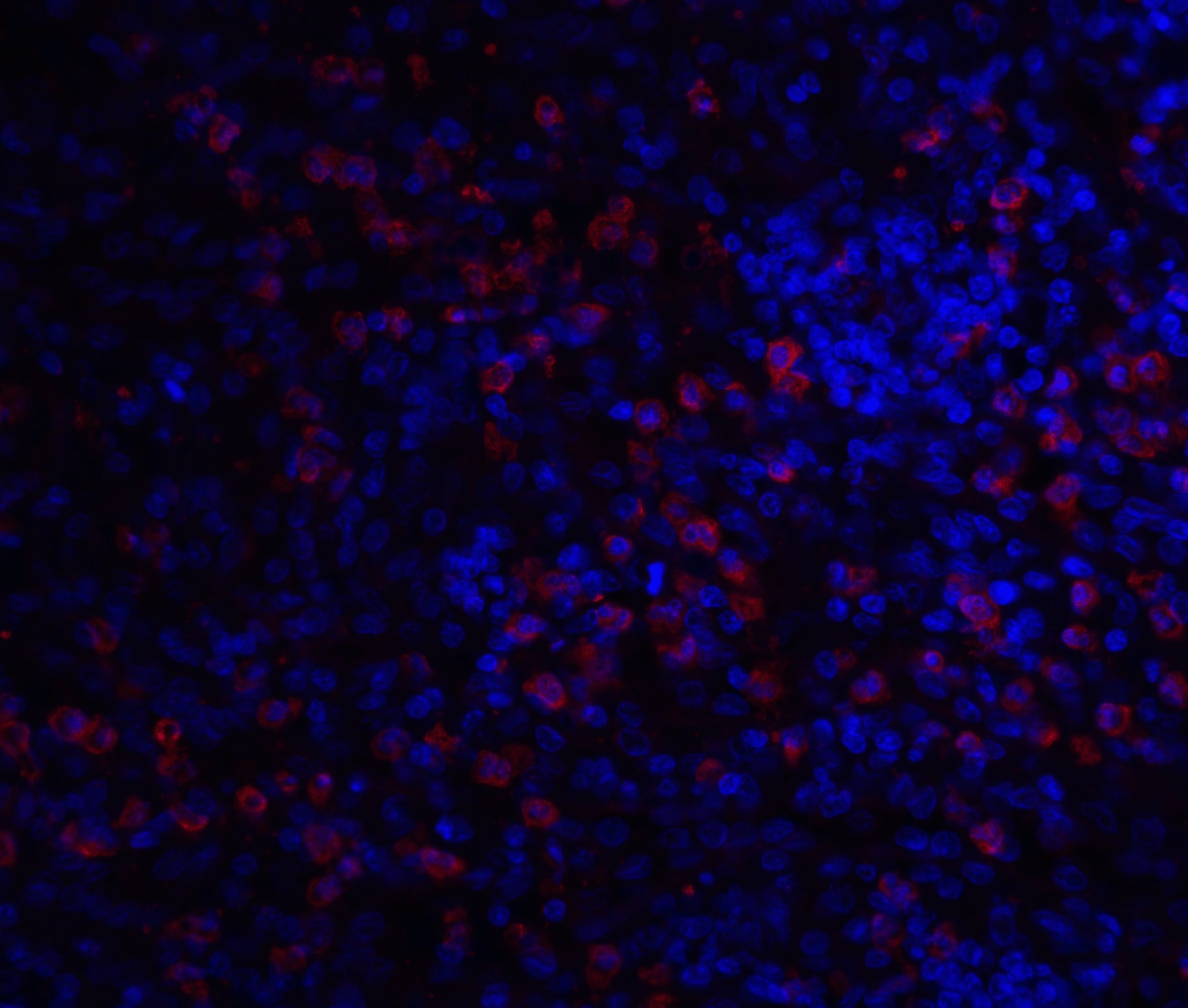 IRAK3 Antibody - BSA Free